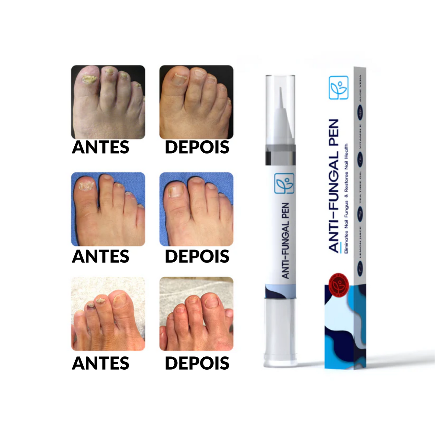 Caneta antifúngica